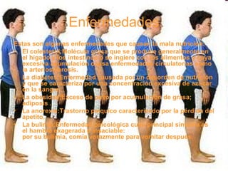 Enfermedades
Estas son algunas enfermedades que causan la mala nutrición:
• El colesterol:Molécula grasa que se produce generalmente en
el hígado y los intestinos o se ingiere con los alimentos y cuya
excesiva acumulación causa enfermedades circulatorias como
la arteriosclerosis.
• La diabetes:Enfermedad causada por un desorden de nutrición
y que se caracteriza por una concentración excesiva de azúcar
en la sangre.
• La obesidad:Exceso de peso por acumulación de grasa;
adiposis .
• La anorexia:Trastorno psíquico caracterizado por la pérdida del
apetito.
• La bulimia:Enfermedad psicológica cuyo principal síntoma es
el hambre exagerada e insaciable:
por su bulimia, comía vorazmente para vomitar después.
 