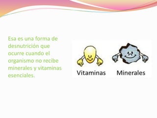 Esa es una forma de
desnutrición que
ocurre cuando el
organismo no recibe
minerales y vitaminas
esenciales.
 