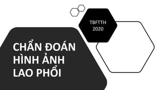 CHẨN ĐOÁN
HÌNH ẢNH
LAO PHỔI
TBFTTH
2020
 