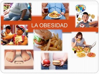 LA OBESIDAD 
 