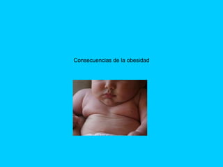 Consecuencias de la obesidad 
