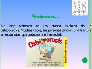Síntomas…
No hay síntomas en las etapas iniciales de la
osteoporosis. Muchas veces, las personas tendrán una fractura
antes de saber que padecen la enfermedad.
 
