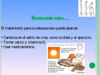 Tratamiento…
El tratamiento para la osteoporosis puede abarcar:

• Cambios en el estilo de vida, como la dieta y el ejercicio. 
• Tomar calcio y vitamina D. 
• Usar medicamentos.
 