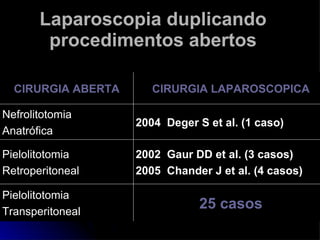 Laparoscopia duplicando procedimentos abertos 25 casos Pielolitotomia Transperitoneal 2002  Gaur DD et al. (3 casos) 2005  Chander J et al. (4 casos)  Pielolitotomia Retroperitoneal 2004  Deger S et al. (1 caso) Nefrolitotomia  Anatrófica  CIRURGIA LAPAROSCOPICA CIRURGIA ABERTA 