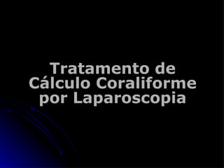 Tratamento de Cálculo Coraliforme por Laparoscopia 