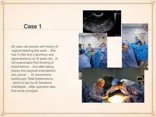Case 1
69 years old woman with history of
vaginal bleeding last week .. She
has 3 child and 2 abortions and
appendectomy at 30 years old .. In
US examination find thinking of
endometrium .. And after taking
biopsy find atypical endometrium
non cancer … Dr recommend
endoscopic Total hysterectomy
..which is don by Dr Samlome
chikhladze .. After operation also
find some of polyps
 