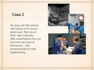 Case 2
48 years old fatty woman
with history of of chronic
pelvic pain. She have 2
child with 3 abortion ..
After examinations find out
she have big mass of
lieomyoma . She
recommended for total
hysterectomy
 