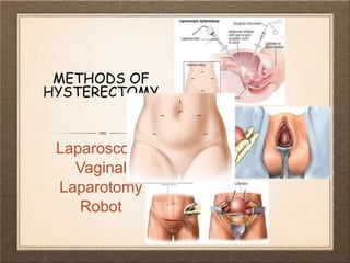METHODS OF
HYSTERECTOMY
Laparoscopy
Vaginal
Laparotomy
Robot
 