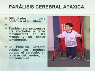 PARÁLISIS CEREBRAL ATÀXICA. Dificultades para controlar el equilibrio. También son propensos los afectados a tener movimientos en las manos y un hablar tembloroso.  La Parálisis Cerebral atáxica se produce porque el cerebelo, en la base del cerebro, no funciona bien. 