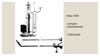 ◦ Nitze 1878
Lámpara
incandescente
Cistoscopía
 