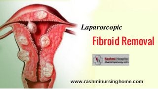 Laparoscopic
Fibroid Removal
www.rashminursinghome.com
 