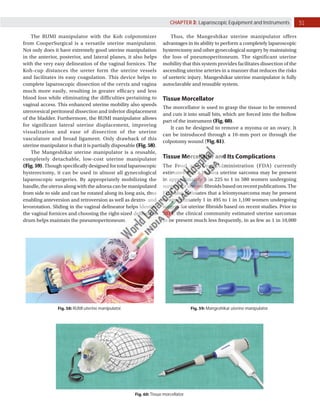 Laparoscopic Equipment and Instruments | PDF