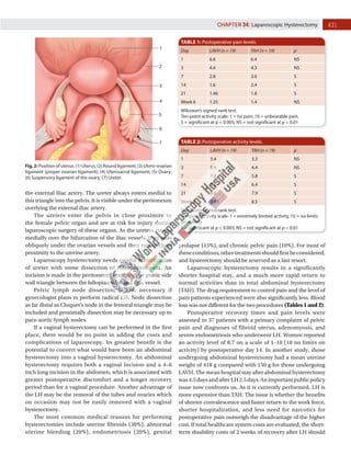 431
CHAPTER 34: Laparoscopic Hysterectomy
TABLE 1: Postoperative pain levels.
Day LAVH (n = 19) TAH (n = 19) p
1 6.6 6.4 NS
3 4.4 4.3 NS
7 2.8 3.6 S
14 1.6 2.4 S
21 1.46 1.8 S
Week 6 1.35 1.4 NS
Wilcoxon’s signed-rank test.
Ten-point activity scale: 1 = no pain; 10 = unbearable pain.
S = significant at p < 0.005; NS = not significant at p < 0.01
Fig. 2: Position of uterus. (1) Uterus; (2) Round ligament; (3) Utero-ovarian
ligament (proper ovarian ligament); (4) Uterosacral ligament; (5) Ovary;
(6) Suspensory ligament of the ovary; (7) Ureter.
the external iliac artery. The ureter always enters medial to
this triangle into the pelvis. It is visible under the peritoneum
overlying the external iliac artery.
The ureters enter the pelvis in close proximity to
the female pelvic organ and are at risk for injury during
laparoscopic surgery of these organs. As the ureters course
medially over the bifurcation of the iliac vessels, they pass
obliquely under the ovarian vessels and then run in close
proximity to the uterine artery.
Laparoscopy hysterectomy needs careful identification
of ureter with some dissection of retroperitoneum. An
incision is made in the peritoneum overlying the pelvic side
wall triangle between the fallopian tube and iliac vessel.
Pelvic lymph node dissection is also necessary if
gynecologist plans to perform radical LH. Node dissection
as far distal as Cloquet’s node in the femoral triangle may be
included and proximally dissection may be necessary up to
para-aortic lymph nodes.
If a vaginal hysterectomy can be performed in the first
place, there would be no point in adding the costs and
complications of laparoscopy. Its greatest benefit is the
potential to convert what would have been an abdominal
hysterectomy into a vaginal hysterectomy. An abdominal
hysterectomy requires both a vaginal incision and a 4–6
inch long incision in the abdomen, which is associated with
greater postoperative discomfort and a longer recovery
period than for a vaginal procedure. Another advantage of
the LH may be the removal of the tubes and ovaries which
on occasion may not be easily removed with a vaginal
hysterectomy.
The most common medical reasons for performing
hysterectomies include uterine fibroids (30%), abnormal
uterine bleeding (20%), endometriosis (20%), genital
prolapse (15%), and chronic pelvic pain (10%). For most of
theseconditions,othertreatmentsshouldfirstbeconsidered,
and hysterectomy should be reserved as a last resort.
Laparoscopic hysterectomy results in a significantly
shorter hospital stay, and a much more rapid return to
normal activities than in total abdominal hysterectomy
(TAH). The drug requirement to control pain and the level of
pain patients experienced were also significantly less. Blood
loss was not different for the two procedures (Tables 1 and 2).
Postoperative recovery times and pain levels were
assessed in 37 patients with a primary complaint of pelvic
pain and diagnoses of fibroid uterus, adenomyosis, and
severe endometriosis who underwent LH. Women reported
an activity level of 8.7 on a scale of 1–10 (10 no limits on
activity) by postoperative day 14. In another study, those
undergoing abdominal hysterectomy had a mean uterine
weight of 418 g compared with 150 g for those undergoing
LAVH. The mean hospital stay after abdominal hysterectomy
was4.5daysandafterLH2.5days.Animportantpublicpolicy
issue now confronts us. As it is currently performed, LH is
more expensive than TAH. The issue is whether the benefits
of shorter convalescence and faster return to the work force,
shorter hospitalization, and less need for narcotics for
postoperative pain outweigh the disadvantage of the higher
cost. If total healthcare system costs are evaluated, the short-
term disability costs of 2 weeks of recovery after LH should
TABLE 2: Postoperative activity levels.
Day LAVH (n = 19) TAH (n = 19) p
1 3.4 3.3 NS
3 5.4 4.4 NS
7 7.8 5.8 S
14 9.2 6.4 S
21 9.6 7.9 S
Week 6 9.95 8.5 S
Wilcoxon’s signed-rank test.
Ten-point activity scale: 1 = extremely limited activity, 10 = no limits
on activity
S = significant at p < 0.005; NS = not significant at p < 0.01
 
