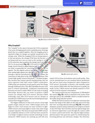 22 SECTION 1: Essentials of Laparoscopy
Fig. 30: Laparoscopic camera.
Fig. 29: Olympus VISERA 3D platform.
Why Coupled?
The “coupled” in the name is because the CCD is comprised
of an array of imaging pixels and a matching array of storage
pixels that are coupled together. After the imaging array is
exposed to light, its charges are quickly transferred to the
storage array. While the imaging CCDs are being exposed
to the next picture, the storage CCDs from the last picture
are being read out a row at a time to the analog-to-digital
(A/D) converters that transform the charges into binary data
(0/1) to be processed (Fig. 32). CCD and CMOS are both
image sensors found in digital laparoscopic cameras. They
are what is responsible for converting light into electronic
signals. The first digital cameras used CCD to turn images
from analog light signals into digital pixels. They are made
through a special manufacturing process that allows the
conversion to take place in the chip without distortion. This
creates high quality sensors that produce excellent images.
But, because they require special manufacturing, they are
more expensive than their newer CMOS counterparts.
CMOS chips use transistors at each pixel to move the charge
through traditional wires. This offers flexibility because each
pixel is treated individually. Traditional manufacturing
processes are used to make CMOS. It is the same as creating
microchips. Because they are easier to produce, CMOS
sensors are cheaper than CCD sensors. Because CMOS
technology came after CCD sensors and are cheaper to
manufacture,CMOSsensorsarethereasonthatlaparoscopic
cameras have dropped in price.
The biggest difference is that CCD sensors create high
quality images with low noise. CMOS images tend to be
higher in noise. CCD sensors are more sensitive to light.
CMOS sensors need more light to create a low noise image
at proper exposure. This does not mean that CMOS sensors
are completely inferior to CCD. CCD has been around for
a lot longer in digital cameras and the technology is more
advanced. CMOS sensors are catching up and will soon
match CCD in terms of resolution and overall quality. They
can be manufactured on any standard silicon production
line and are much more inexpensive when compared to
CCD sensors. Eventually economics will someday make
every camera CMOS when the final advances in quality are
made. In fact, CMOS sensors are already superior to CCD
sensors in terms of power consumption.
The camera system has two components: (1) the head of
the camera (Fig. 33), which is attached to the ocular of the
telescope and (2) the controller, which is usually located on
the trolley along with the monitor.
Within the head of camera is an objective zoom lens that
focuses the image of the object on the chip and a CCD chip
that “sees” an image taken by telescope (Fig. 34). All modern
miniature cameras used in minimal access surgery are based
on the CCD chip. The CCD then converts optical image into
an electrical signal that is sent through the camera cable
to camera control unit (CCU). The chip has light-sensitive
photoreceptors that generate pixels by transforming the
incoming photons into electronic charges. The electronic
Remove Watermark Wondershare
PDFelement
 