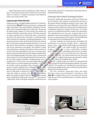 25
CHAPTER 2: Laparoscopic Imaging Systems
White balancing is done by keeping any white object in
front of telescope attached with camera that senses white
object as reference. It adjusts its primary color (RGB) to
make a pure natural white color.
Laparoscopic Video Monitor
Surgical monitors are slightly different from the TV which we
watch at home (Fig. 35). Monitor lasts long so a surgeon gets
high-end product with at least 600 lines resolution. The size
of the screen varies generally from 8 to 29 inches. The closure
the laparoscopic surgeon is to the monitor, the smaller the
monitor should be to get better picture. The basic principle
of image reproduction is horizontal beam scanning on
the face of the picture tube. This plate is coated internally
with a fluorescent substance containing phosphorus. This
generates electrons when struck by beams from the electron
gun. As the beam sweeps horizontally and back, it covers all
the picture elements before reaching its original position.
This occurs repetitively and rapidly. This method is called
horizontal linear scanning. Each picture frame consists of
several such lines depending on the type of system used.
Distanceofmonitorfromtheeyeofthesurgeonshouldbefive
times to the diagonal length of monitor screen. It means that
if the monitor is 21 inch it should be kept 105 inch away from
the eye of the surgeon. Nowadays, 4K laparoscopic monitor
is preferred. It is also known as an ultra-high definition or
UHD monitor, is one that supports 4K resolution. This brings
up another common question: what is 4K resolution? The
answer is simple. Standard HD or 1,080 pixels (as found on
Blu-Ray disks and HD televisions) is made up of a picture
that is 1,920 pixels in width and 1,080 pixels in height. In
total, this results in a picture with more than two million
pixels. The width of a picture that has 4K resolution contains
almost 4,000 pixels (3,840 pixels to be precise—twice that of
1,080 pixels). With 2,160 pixels along the vertical side, the
total number of pixels on a 4K monitor is four times that of a
traditional HD monitor.
Endoscopic Vision (Video) Technology Evolution
In the past, endoscopic procedures were done without the
aid of monitors. The operator visualized the interiors of
the patient directly through the eyepiece of the scope. This
method was associated with many difficulties. He was the
onlypersonwhocouldobservetheprocedureleadingtopoor
coordination with other members of the team. As a result,
extensive and difficult procedures could not be performed.
The magnification was very poor. Surgeons had to face
problems with posture leading to discomfort and strain as
his eye was always glued to the eyepiece. He had difficulties
in orientation due to visualizing with only one eye.
As better methods of communication developed, the
introduction of television brought about a significant
impact. A good magnification of the image was reproduced.
All members of the team could visualize the procedure.
Surgeons could operate more comfortably. Complex
procedures began to be undertaken and were even recorded.
Soulas in France first used television for endoscopic
procedures in 1956. He demonstrated the first televised
bronchoscopy. A rigid bronchoscope was attached to a black
and white camera that weighed about 100 lbs.
In 1959, a laparoscopic procedure was demonstrated
usingaclosedcircuittelevisionprogramusingthe“Fourestier
method”
. This method was developed by transmitting an
intense beam of light along a quartz rod from the proximal to
distal ends of the laparoscope.
The first miniature endoscopic black and white
television camera was developed in Australia in 1960
(Fig. 36). It weighed 350 g, was 45 mm wide, and 120 mm
long. Because of its small dimensions, it could be attached
to the eyepiece.
Fig. 35: Laparoscopic 4K monitor. Fig. 36: Endoscopic camera.
Remove Watermark Wondershare
PDFelement
 