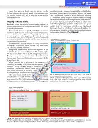 27
CHAPTER 2: Laparoscopic Imaging Systems
Apart from pictorial depth cues, the picture can be
further disturbed by anticues. These may originate from
the monitor. Glaring effect due to reflection is one of these
important anticues.
Imaging Technical Terms
Resolution means the degree of sharpness of a displayed or
printed image; simply, the ability of a television or film image
to reproduce fine detail.
Resolution is defined as (pixels per inch) the maximum
number of pixels that can be displayed on a screen monitor,
expressed as (number of horizontal pixels) × (number of
vertical pixels), i.e., 1,024 × 768 pixels. The ratio of horizontal
to vertical resolution is usually 4:3, the same as that of
conventional television sets.
For a monitor, a screen resolution of 1,920 × 1,200 means
1,920 pixels horizontally across each of 1,200 lines, which
run vertically from top to bottom.
For printers and scanners, resolution is expressed as the
number of dots per linear inch [printed dots per inch (dpi)].
300 dpi means 300 × 300 or 90,000 dots per square inch.
Laser printers and plotters have resolutions from 300 to 1,200
dpi and more whereas most display screens provide <100 dpi
(Figs. 37 and 38).
Gain controls the brightness of the image under
conditions of low light by recruiting pixels to increase signal
strength. Clearly, this step results in some loss of image
resolution. This increases light but results in a grainy picture
with poorer resolution. It also may create a loss of color
accuracy owing to amplification of the noise-to-signal ratio.
The gain should be off at the beginning of a routine
procedure (not needed in routine situations). There are two
good reasons for this. First, inadequate light at the beginning
of the procedure is an indication that a piece of equipment
is malfunctioning, a situation that should be rectified before
getting too involved with the procedure. Second, the use of
“gain” comes at the expense of picture resolution, resulting
in a somewhat grainy image on the monitor while turning
the brightness knob to maximum produces a very washed-
out picture. A good general rule of thumb to follow is to
look in the right upper quadrant and visualize the space
over the liver. The entire dome of the liver and right lateral
diaphragm should be well-lit and easily seen. If not, then the
lighting system should be evaluated and optimized prior to
beginning the dissection (Figs. 39A and B).
Fig. 38: Wide and larger screen resolution (16:9) aspect ratio, i.e., the width is more than the height.
(QWXGA: Quad Wide Extended Graphics Array; WQSXGA: Wide Quad Super Extended Graphics Array; WQUXGA: Wide Quad Ultra Extended Graphics
Array; WSXGA: Wide Super Extended Graphics Array; WUXGA: Wide Ultra Extended Graphics Array; WXGA: Wide Extended Graphics Array)
Fig. 37: Standard screen resolution (4:3) aspect ratio, i.e., the height is
somewhat approximates to the width.
(QXGA: Quad Extended Graphics Array; SVGA: Super Video Graphics
Array; SXGA: Super Extended Graphics Array; UXGA: Ultra Extended
Graphics Array; VGA: Video Graphics Array)
Remove Watermark Wondershare
PDFelement
 