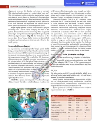 32 SECTION 1: Essentials of Laparoscopy
in 2D pictures. This improves the sense of depth and it does
not require binocular depth cues. It is also said to reduce
fatigue and eyestrain. However, this system does not bring
about any changes to resolution, brightness, and color.
Augmented reality (AR) is a 3D computer vision
technique that is characterized by the real-time fusion
of virtual elements on a real space. Currently, AR offers
enormous potential in many fields such as education,
simulation, architecture, advertising, navigation devices,
medicine, and rehabilitation. Minimal access surgery
is the branch of medicine where AR has more potential
for application. New innovations such as Microsoft
HoloLens and the emerging mass market of VR headsets
would indicate that these technologies will become
familiar to surgeons and inevitability we will find a way
to integrate them into our day-to-day practice. The challenge
of identifying compelling and valuable experiences for
these modalities now begins along with validation of their
benefits in all aspects of surgical care. The digital surgical
environment is about to drastically change in near future.
Advancement in TV System Technology
High-definition and Ultra-high Definition Television
Another remarkable advancement in technology is the high-
definition television (HDTV) and 4K TV. It uses component
signals, the resolution of the picture is much better, and there
are no distortions.
PALplus
The alternatives to HDTV are the PALplus which is an
advanced modification of PAL and D2-MAC, HD-MAC which
are used for satellite transmissions.
These systems, however, require large amounts of space
and can cause problems during transmission. Due to the
increased definition, small unwanted movements can be
magnified and visual stress can be increased.
Some systems are currently under evaluation and their
requirements are given in Table 3.
Fig. 46: Projection systems in minimal access surgery.
alignment between his hands and eyes to normal.
This principle has been used in a project called “view-site”
.
This mechanism is used to project the operative field image
onto a sterile screen placed on the patient’s abdomen close
to the original area of surgery. However, it cannot be used for
extensive procedures as the image field is small, resolution
is not up to the mark, and separation and identification of
tissue planes become difficult if bleeding was to occur.
Image display systems are now available which project
the image onto a sterile screen overlying the chest of the
patient. This aids both cerebral processing of the image and
endoscopic manipulations and improves both quality and
efficiency of performance (Fig. 46). The limitations of the
current “gaze-down” image display systems are diminished
resolution and encroachment of the operative field by the
sterile screen.
Suspended Image System
An experimental system [suspended image system (SIS)]
being developed at the University of Dundee and the Central
Research Laboratory (EMI) projects the image in air on top of
the patient, which means that there is no screen to obstruct
the surgeon’s movement. This is called the SIS. It consists
of two components: (1) a high precision retroreflector and
(2) a beam splitter. With the help of these, the system can
produce images with good resolution and can suspend them
on top of the patient in close vicinity to the operative site.
The advantages of this method are that there is no distortion,
object can be placed anywhere, focal length is not specific,
and the image is similar to the original in size. This system
is also said to improve the sense of depth, as there are no
anticues. Also, the visual-motor axis is correctly aligned for
optimal performance.
VISTRAL is a system currently under trial. The advantage
of this system is that it does not allow flatness cues to occur
TABLE 3: Different types of TV system.
System
Japan
(NHK/Sony)
Europe
(EUREKA 95) USA
Number of lines 1,125 1,250 1,050
Visible lines (92%) 1,035 1,150 966
Pixels per line 1,831 2,035 1,709
Total number of pixels 1,895,085 2,340,250 1,650,894
Field frequency [cycles per
second (cps)]
60 50 59
Luminance 20 20 20
Chrominance 7 7 7
Remove Watermark Wondershare
PDFelement
 