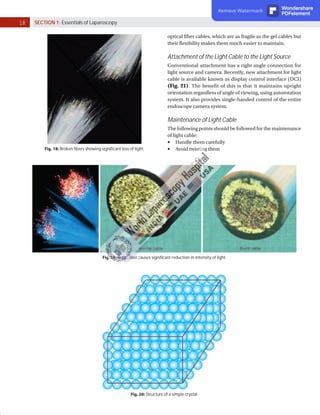 18 SECTION 1: Essentials of Laparoscopy
Fig. 18: Broken fibers showing significant loss of light.
Fig. 19: Burnt fiber causes significant reduction in intensity of light.
Fig. 20: Structure of a simple crystal.
optical fiber cables, which are as fragile as the gel cables but
their flexibility makes them much easier to maintain.
Attachment of the Light Cable to the Light Source
Conventional attachment has a right angle connection for
light source and camera. Recently, new attachment for light
cable is available known as display control interface (DCI)
(Fig. 21). The benefit of this is that it maintains upright
orientation regardless of angle of viewing, using autorotation
system. It also provides single-handed control of the entire
endoscope camera system.
Maintenance of Light Cable
The following points should be followed for the maintenance
of light cable:
	
■ Handle them carefully
	
■ Avoid twisting them
Remove Watermark Wondershare
PDFelement
 
