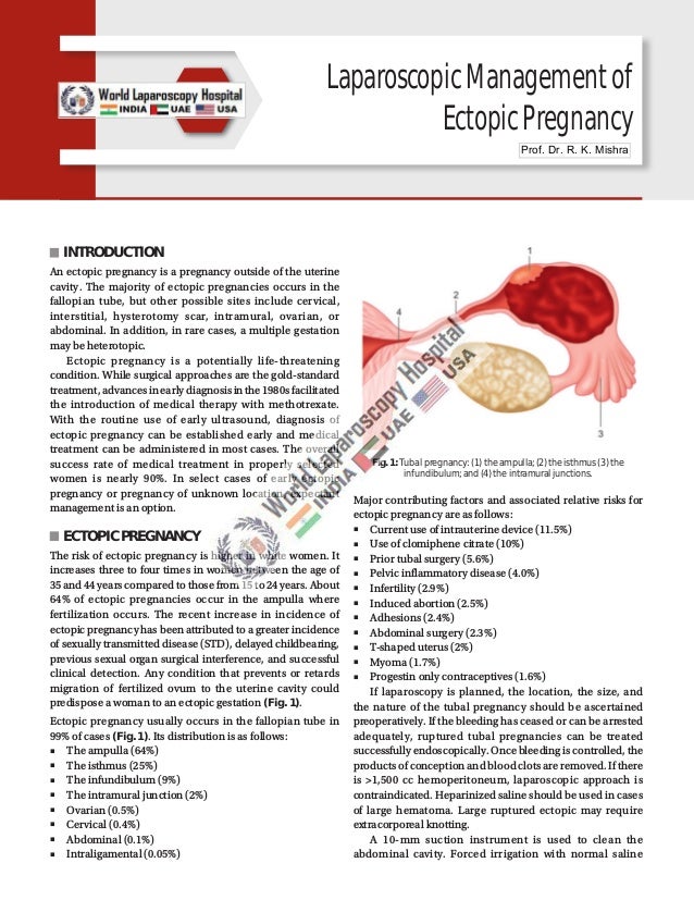 Laparoscopic Management of Ectopic Pregnancy