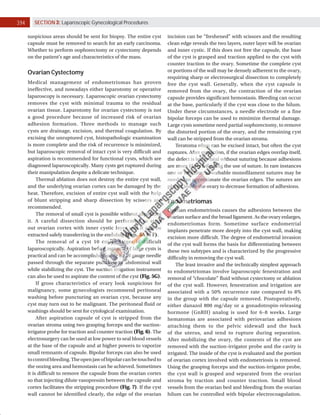 394 SECTION 3: Laparoscopic Gynecological Procedures
suspicious areas should be sent for biopsy. The entire cyst
capsule must be removed to search for an early carcinoma.
Whether to perform oophorectomy or cystectomy depends
on the patient’s age and characteristics of the mass.
Ovarian Cystectomy
Medical management of endometriomas has proven
ineffective, and nowadays either laparotomy or operative
laparoscopy is necessary. Laparoscopic ovarian cystectomy
removes the cyst with minimal trauma to the residual
ovarian tissue. Laparotomy for ovarian cystectomy is not
a good procedure because of increased risk of ovarian
adhesion formation. Three methods to manage such
cysts are drainage, excision, and thermal coagulation. By
excising the unruptured cyst, histopathologic examination
is more complete and the risk of recurrence is minimized,
but laparoscopic removal of intact cyst is very difficult and
aspiration is recommended for functional cysts, which are
diagnosed laparoscopically. Many cysts get ruptured during
their manipulation despite a delicate technique.
Thermal ablation does not destroy the entire cyst wall,
and the underlying ovarian cortex can be damaged by the
heat. Therefore, excision of entire cyst wall with the help
of blunt stripping and sharp dissection by scissors are
recommended.
The removal of small cyst is possible without aspirating
it. A careful dissection should be performed to strip
out ovarian cortex with inner cystic layer and it can be
extracted safely transferring in the endobag (Figs. 5A to F).
The removal of a cyst 10 cm or larger is difficult
laparoscopically. Aspiration before removal of large cysts is
practical and can be accomplished using an 18 gauge needle
passed through the separate puncture of abdominal wall
while stabilizing the cyst. The suction irrigation instrument
can also be used to aspirate the content of the cyst (Fig. 5G).
If gross characteristics of ovary look suspicious for
malignancy, some gynecologists recommend peritoneal
washing before puncturing an ovarian cyst, because any
cyst may turn out to be malignant. The peritoneal fluid or
washings should be sent for cytological examination.
After aspiration capsule of cyst is stripped from the
ovarian stroma using two grasping forceps and the suction­
irrigator probe for traction and counter traction (Fig. 6). The
electrosurgery can be used at low power to seal blood vessels
at the base of the capsule and at higher powers to vaporize
small remnants of capsule. Bipolar forceps can also be used
tocontrolbleeding.Theopenjawofbipolarcanbetouchedto
the oozing area and hemostasis can be achieved. Sometimes
it is difficult to remove the capsule from the ovarian cortex
so that injecting dilute vasopressin between the capsule and
cortex facilitates the stripping procedure (Fig. 7). If the cyst
wall cannot be identified clearly, the edge of the ovarian
incision can be “freshened” with scissors and the resulting
clean edge reveals the two layers, outer layer will be ovarian
and inner cystic. If this does not free the capsule, the base
of the cyst is grasped and traction applied to the cyst with
counter traction to the ovary. Sometime the complete cyst
or portions of the wall may be densely adherent to the ovary,
requiring sharp or electrosurgical dissection to completely
free the cyst wall. Generally, when the cyst capsule is
removed from the ovary, the contraction of the ovarian
capsule provides significant hemostasis. Bleeding can occur
at the base, particularly if the cyst was close to the hilum.
Under these circumstances, a needle electrode or a fine
bipolar forceps can be used to minimize thermal damage.
Large cysts sometime need partial oophorectomy, to remove
the distorted portion of the ovary, and the remaining cyst
wall can be stripped from the ovarian stroma.
Teratoma often can be excised intact, but often the cyst
ruptures. After extraction, if the ovarian edges overlap itself,
the defect is left to heal without suturing because adhesions
are more likely following the use of suture. In rare instances
one or two fine, absorbable monofilament sutures may be
needed to approximate the ovarian edges. The sutures are
placed inside the ovary to decrease formation of adhesions.
Endometriomas
Ovarian endometriosis causes the adhesions between the
ovarian surface and the broad ligament. As the ovary enlarges,
endometriomas form. Sometime surface endometrial
implants penetrate more deeply into the cyst wall, making
excision more difficult. The degree of endometrial invasion
of the cyst wall forms the basis for differentiating between
these two subtypes and is characterized by the progressive
difficulty in removing the cyst wall.
The least invasive and the technically simplest approach
to endometriomas involve laparoscopic fenestration and
removal of “chocolate” fluid without cystectomy or ablation
of the cyst wall. However, fenestration and irrigation are
associated with a 50% recurrence rate compared to 8%
in the group with the capsule removed. Postoperatively,
either danazol 800 mg/day or a gonadotropin­releasing
hormone (GnRH) analog is used for 6–8 weeks. Large
hematomas are associated with periovarian adhesions
attaching them to the pelvic sidewall and the back
of the uterus, and tend to rupture during separation.
After mobilizing the ovary, the contents of the cyst are
removed with the suction­irrigator probe and the cavity is
irrigated. The inside of the cyst is evaluated and the portion
of ovarian cortex involved with endometriosis is removed.
Using the grasping forceps and the suction­irrigator probe,
the cyst wall is grasped and separated from the ovarian
stroma by traction and counter traction. Small blood
vessels from the ovarian bed and bleeding from the ovarian
hilum can be controlled with bipolar electrocoagulation.
 