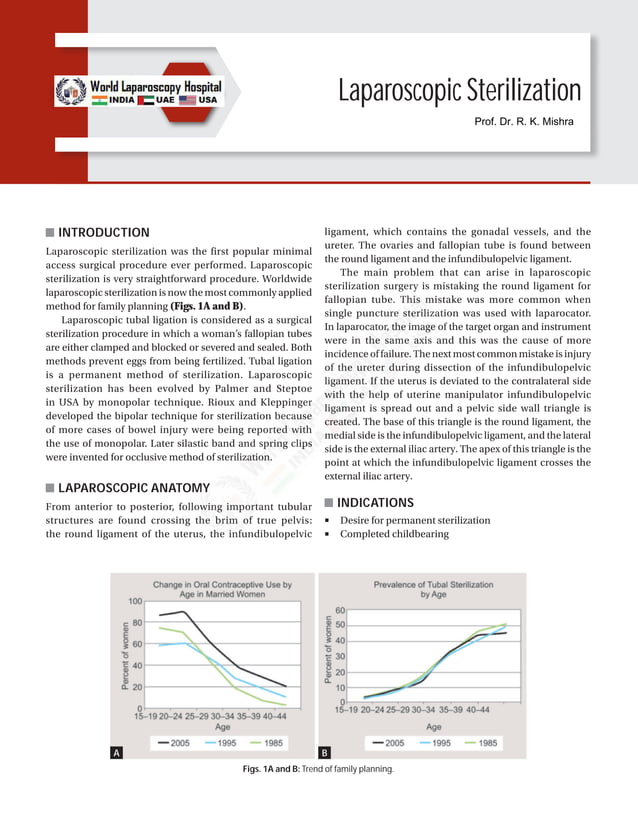 Laparoscopic Sterilization PDF