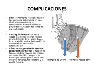 COMPLICACIONES
• Están íntimamente relacionadas con
la experiencia del cirujano en esta
técnica laparoscópica y el
conocimiento anatómico de la vía
preperitoneal. Existen dos zonas de
especial riesgo:
•
• – Triángulo de Doom: los vasos
ilíacos están en su interior y existe
riesgo de lesión de los vasos ilíacos.
Es aconsejable realizar la disección de
los elementos del cordón
externamente.
• – Área de riesgo de lesión nerviosa
(electrical hazard zone): la fijación de
la prótesis debe hacerse por encima
del tracto iliopúbico ya que si se
hiciera por debajo podría lesionarse
el nervio femorocutáneo lateral y el
genito-femoral.
Triángulo de Doom electrical hazard zone
 