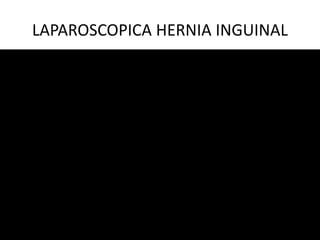 LAPAROSCOPICA HERNIA INGUINAL
 