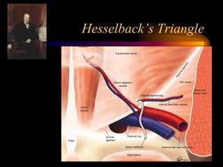 Laparoscopic anatomy of inguinal canal | PPTX