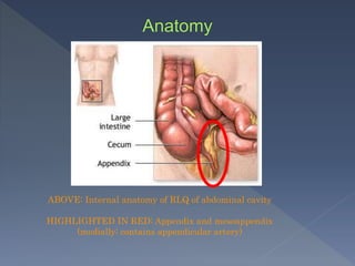 ABOVE: Internal anatomy of RLQ of abdominal cavity
HIGHLIGHTED IN RED: Appendix and mesoappendix
(medially; contains appendicular artery)
 