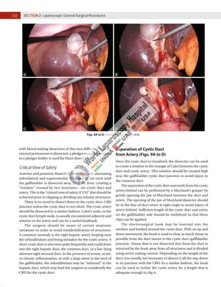 Percutaneous Cholecystostomy. | Gallbladder