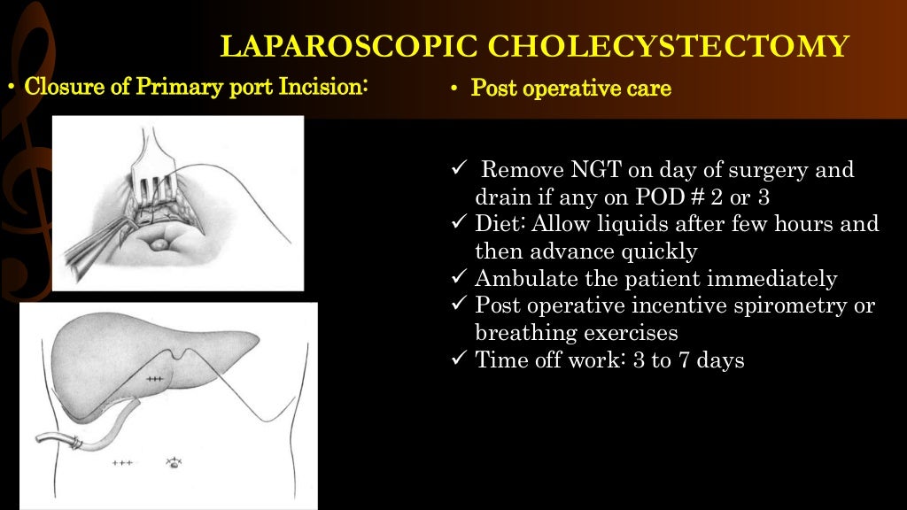 Laparoscopic cholecystectomy/ operative surgery