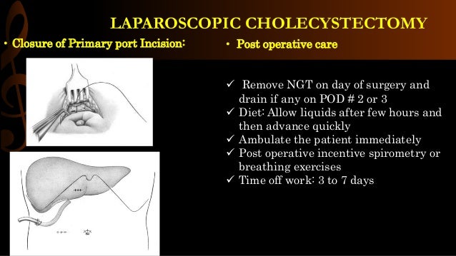 Laparoscopic Cholecystectomy Operative Surgery laparoscopic-cholecystectomy-operative-surgery
