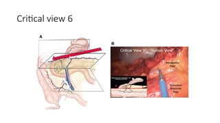surgical techniques laparoscopic colectomy.pptx