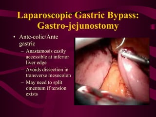Laparoscopic Gastric Bypass: Gastro-jejunostomy Ante-colic/Ante gastric Anastamosis easily accessible at inferior liver edge Avoids dissection in transverse mesocolon May need to split omentum if tension exists 