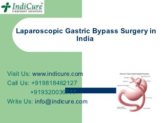 Laparoscopic Gastric Bypass Surgery in
                 India



Visit Us: www.indicure.com
Call Us: +919818462127
         +919320036777
Write Us: info@indicure.com
 