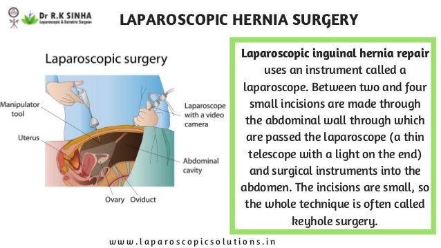 Laparoscopic Hernia Surgery in Mumbai | Hernia Repair Treatment in India