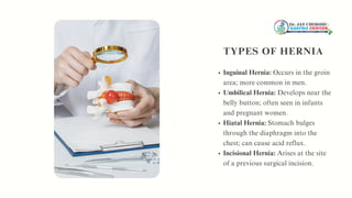 Overview on Advanced Laparoscopic Hernia Surgery | PPT