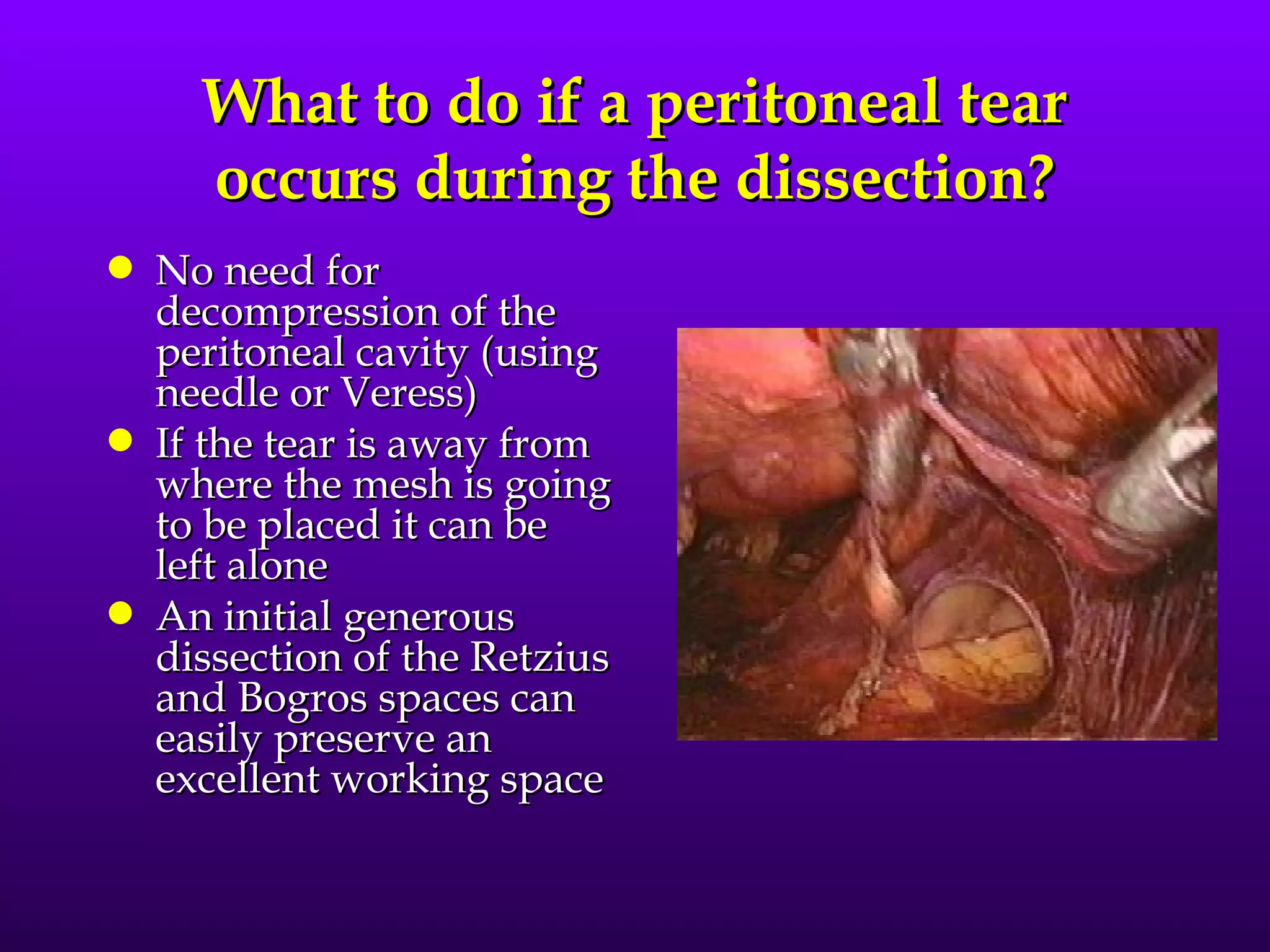 What to do if a peritoneal tear
      occurs during the dissection?
q   No need for
    decompression of the
    peritoneal cavity (using
    needle or Veress)
q   If the tear is away from
    where the mesh is going
    to be placed it can be
    left alone
q   An initial generous
    dissection of the Retzius
    and Bogros spaces can
    easily preserve an
    excellent working space
 