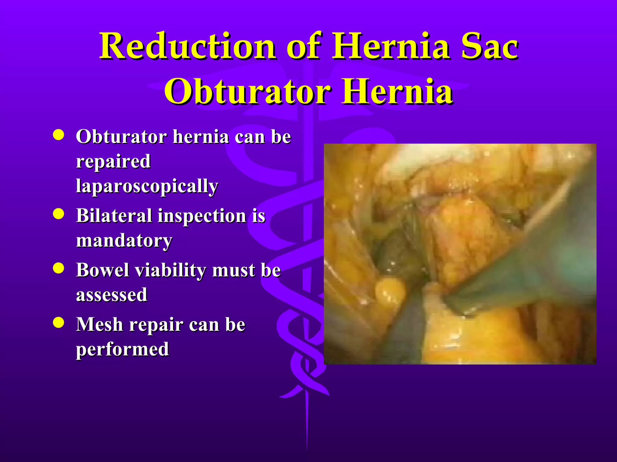 Reduction of Hernia Sac
         Obturator Hernia
q   Obturator hernia can be
    repaired
    laparoscopically
q   Bilateral inspection is
    mandatory
q   Bowel viability must be
    assessed
q   Mesh repair can be
    performed
 