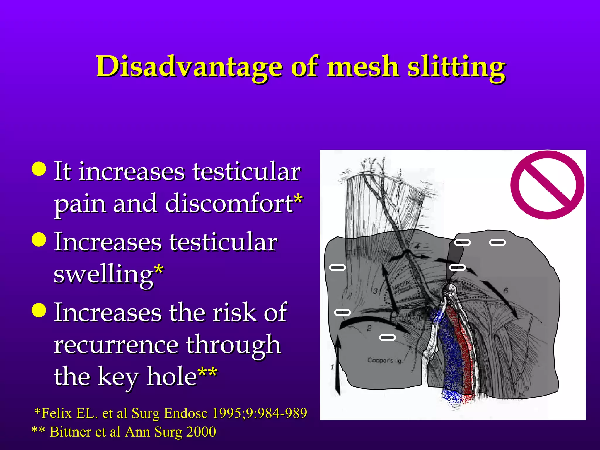 Disadvantage of mesh slitting


q It increases testicular
  pain and discomfort*
q Increases testicular
  swelling*
q Increases the risk of
  recurrence through
  the key hole**
*Felix EL. et al Surg Endosc 1995;9:984-989
** Bittner et al Ann Surg 2000
 