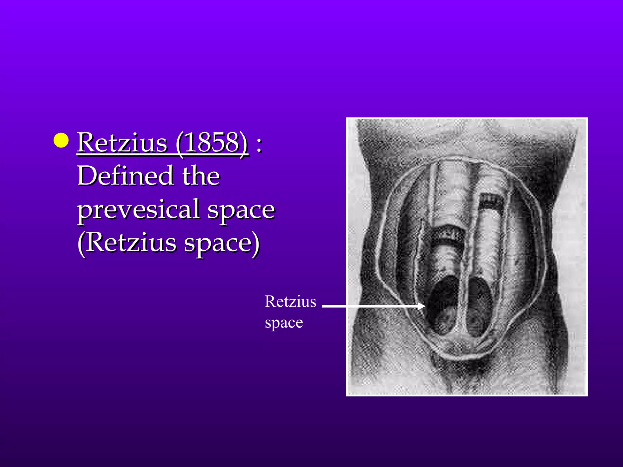 q   Retzius (1858) :
    Defined the
    prevesical space
    (Retzius space)

                   Retzius
                   space
 