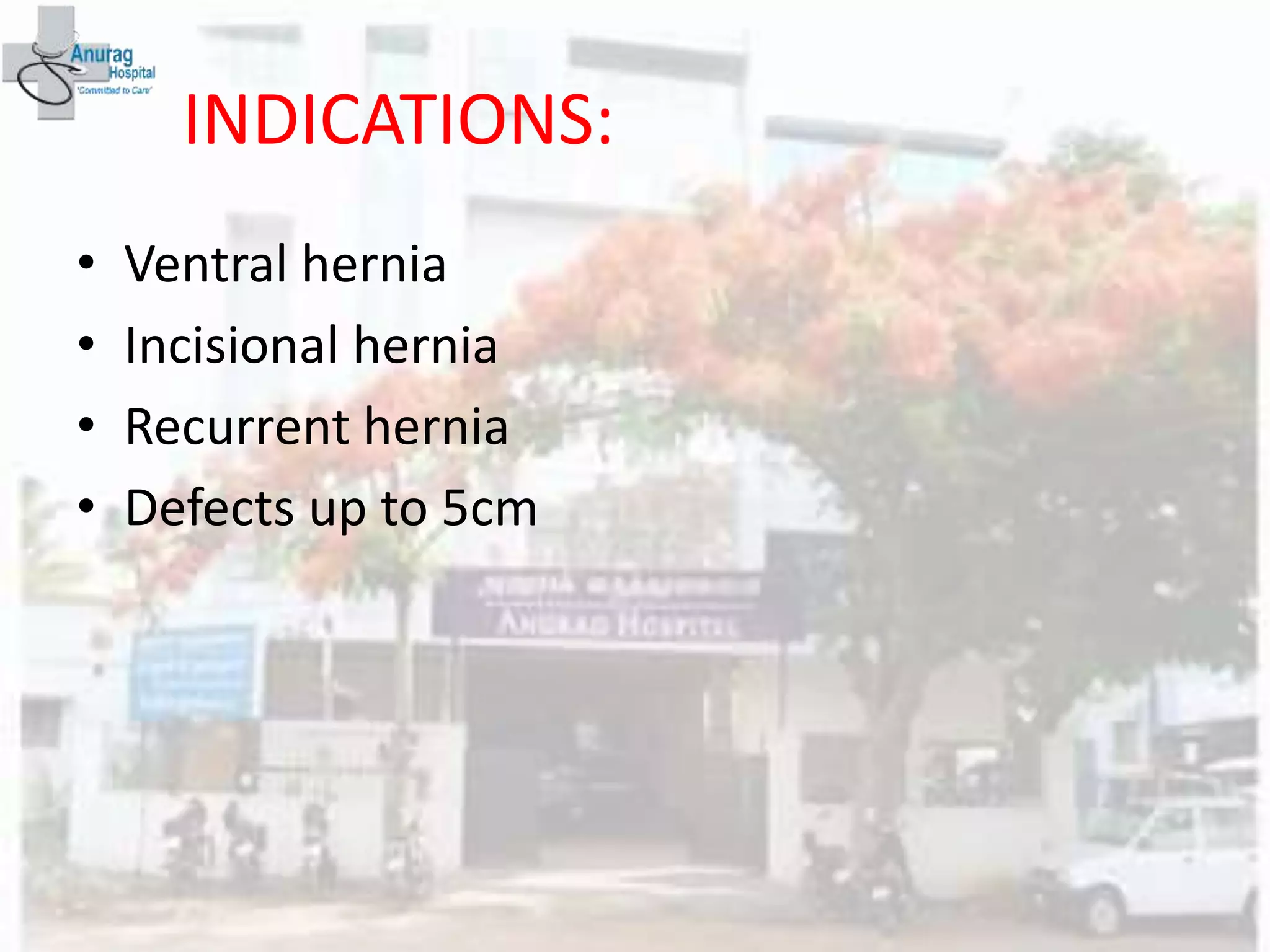INDICATIONS:
• Ventral hernia
• Incisional hernia
• Recurrent hernia
• Defects up to 5cm
 