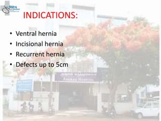 INDICATIONS:
• Ventral hernia
• Incisional hernia
• Recurrent hernia
• Defects up to 5cm
 