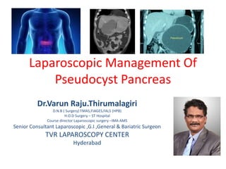 Laparoscopic Management Of
Pseudocyst Pancreas
Dr.Varun Raju.Thirumalagiri
D.N.B ( Surgery) FMAS,FIAGES,FALS (HPB)
H.O.D Surgery – ST Hospital
Course director Laparoscopic surgery –IMA-AMS
Senior Consultant Laparoscopic ,G.I ,General & Bariatric Surgeon
TVR LAPAROSCOPY CENTER
Hyderabad
 
