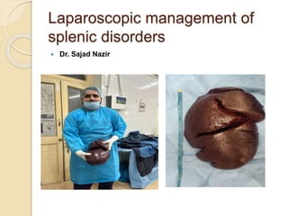 Laparoscopic management of
splenic disorders
 Dr. Sajad Nazir
 