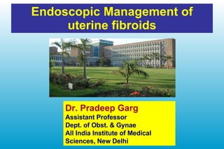 Endoscopic Management of uterine fibroids Dr. Pradeep Garg Assistant Professor Dept. of Obst. & Gynae All India Institute of Medical Sciences, New Delhi 