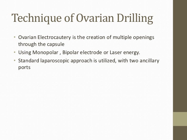 Laparoscopic ovarian drilling