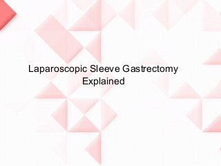Laparoscopic Sleeve Gastrectomy
Explained
 