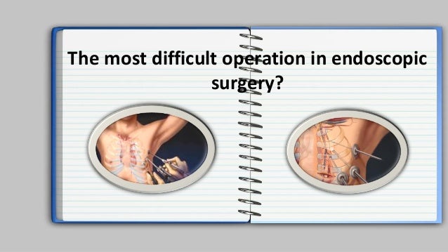 Laparoscopic surgery. Intro. History of Armata manus Laparoscopic surgery. Intro. History of Armata manus