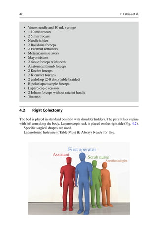 Laparoscopic surgery | PDF
